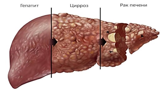 ����������� ������: �� �������� �� �������